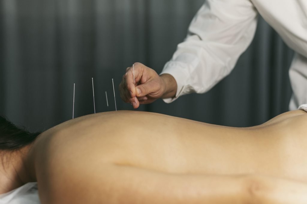 Acupuncturist in Zeist